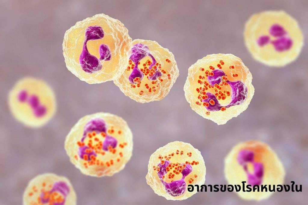 อาการของโรคหนองใน