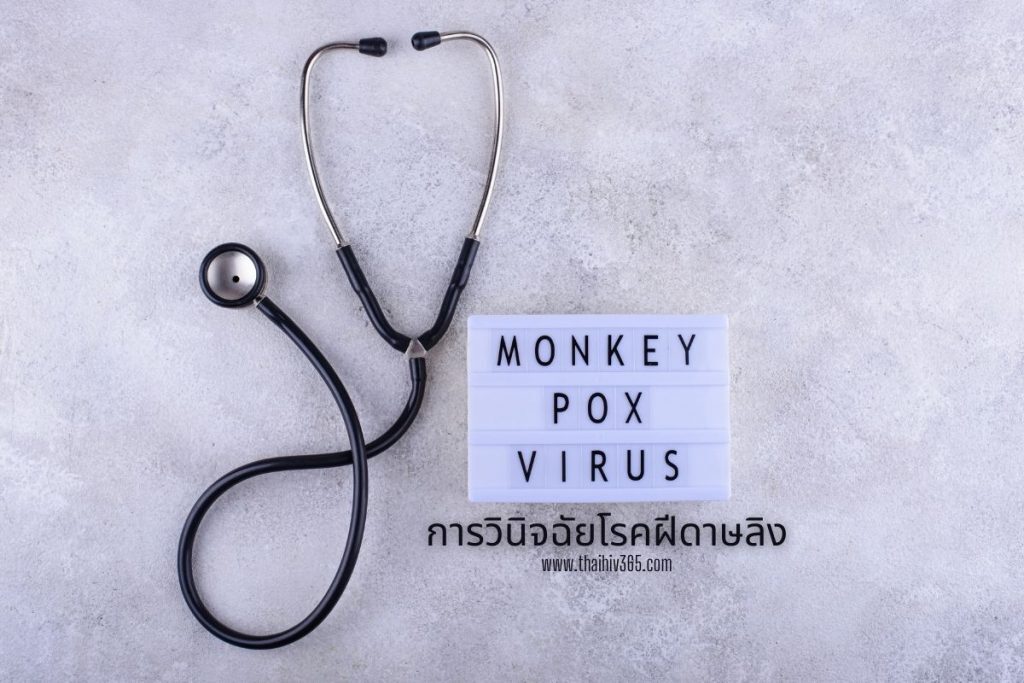 การวินิจฉัยโรคฝีดาษลิง