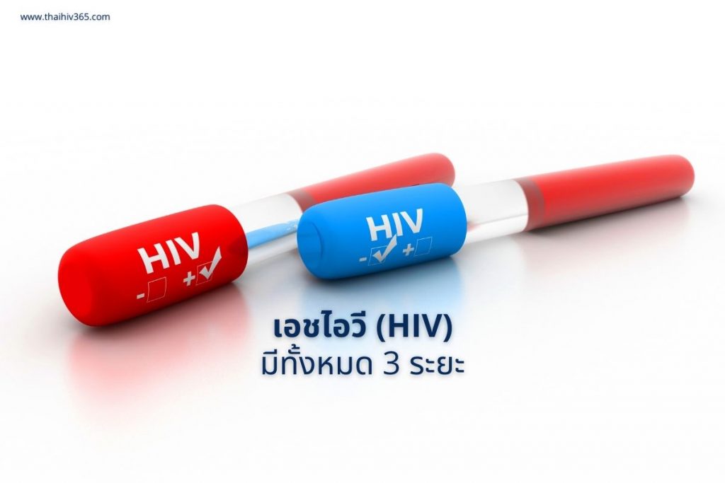 เอชไอวี HIV มีทั้งหมด 3 ระยะ