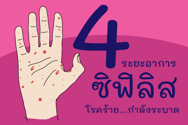 ซิฟิลิส ตรวจซิฟิลิส โรคซิฟิลิส อาการซิฟิลิส รักษาซิฟิลิส ยาซิฟิลิส ฉีดยาซิฟิลิส ติดซิฟิลิส