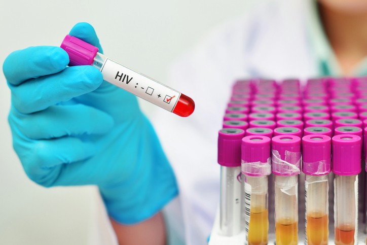 ตรวจเอชไอวี เอดส์ ยารักษาเอดส์ ยาต้านไวรัส ตรวจเอดส์ รักษาเอชไอวี ยาเพร็พ ยาเป๊ป ยาต้านฉุกเฉิน ผลเลือดบวก ผู้อยู่ร่วมกับเอชไอวี วิธีตรวจเอชไอวี
