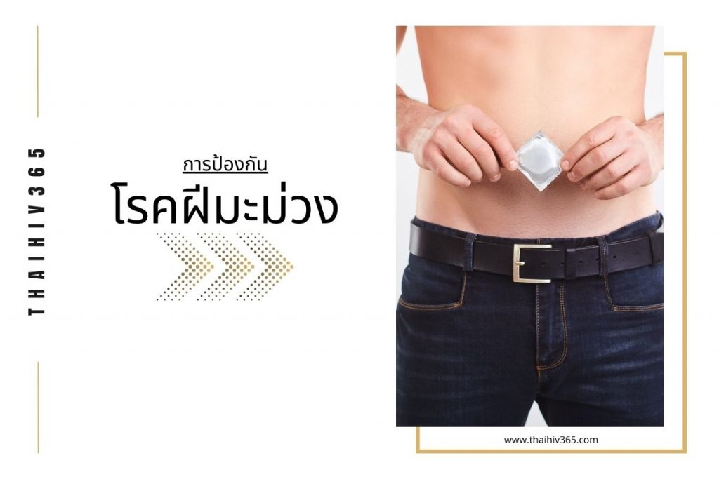 การป้องกัน โรคฝีมะม่วง