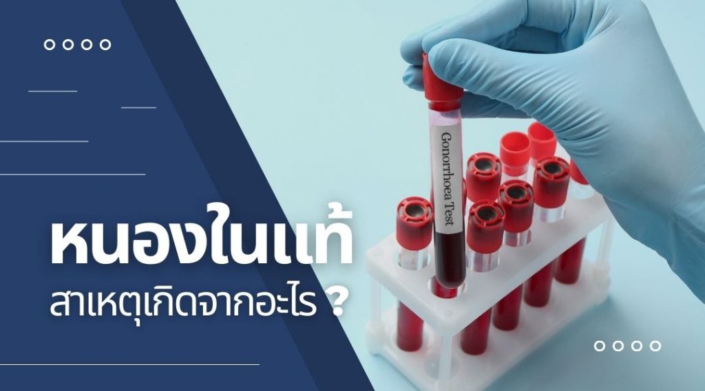 หนองในแท้ สาเหตุเกิดจากอะไร