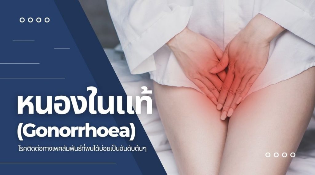 หนองในแท้ (Gonorrhoea) โรคติดต่อทางเพศสัมพันธ์ที่พบได้บ่อยเป็นอันดับต้นๆ