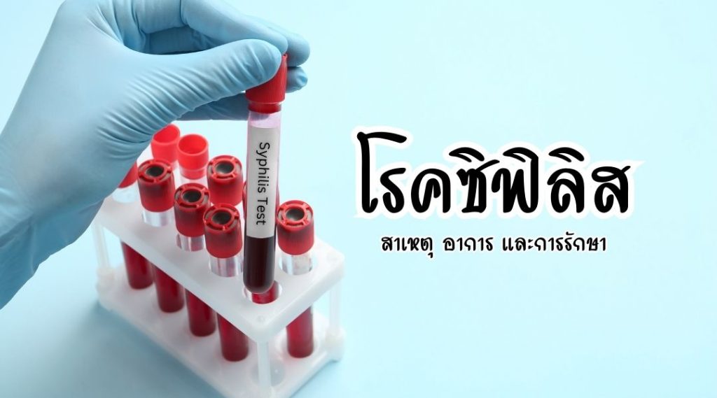 โรคซิฟิลิส สาเหตุ อาการ และการรักษา